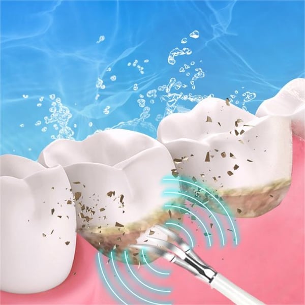 SMILEWAVE™ | Ultrasonic Electric Tooth Cleaner – Perfect Gift for Family & Friends