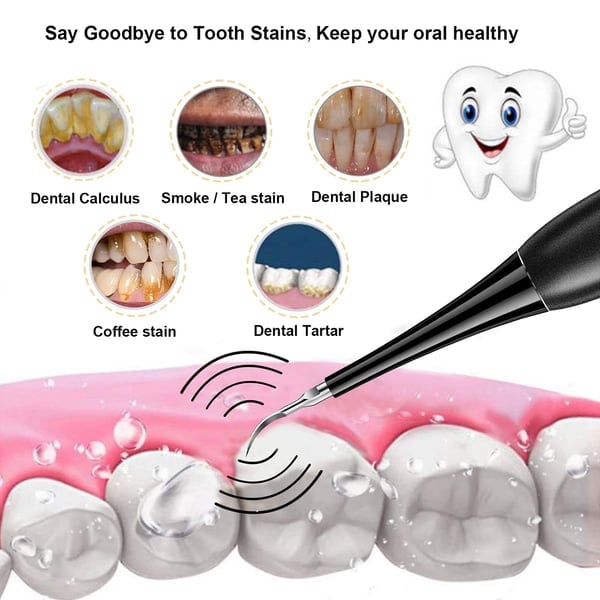 SMILEWAVE™ | Ultrasonic Electric Tooth Cleaner – Perfect Gift for Family & Friends